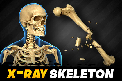 Destructible X‑ray Skeleton