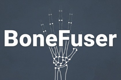 BoneFuser