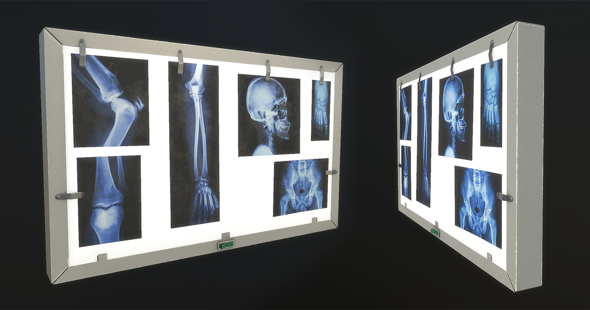 XRay Light Box 3D 道具 Unity Asset Store