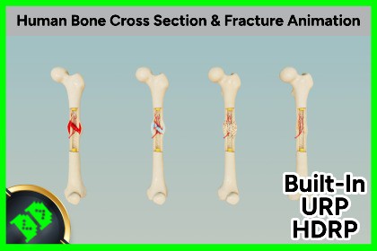 Human Bone Cross Section & Fracture Animation