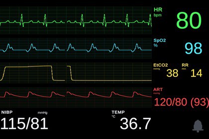 Heart Rate & Vitals Animated UI
