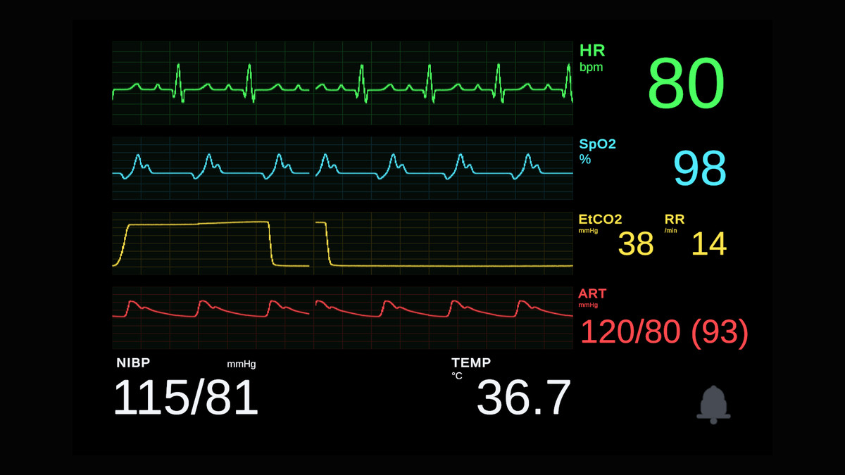 Heart Rate & Vitals Animated UI