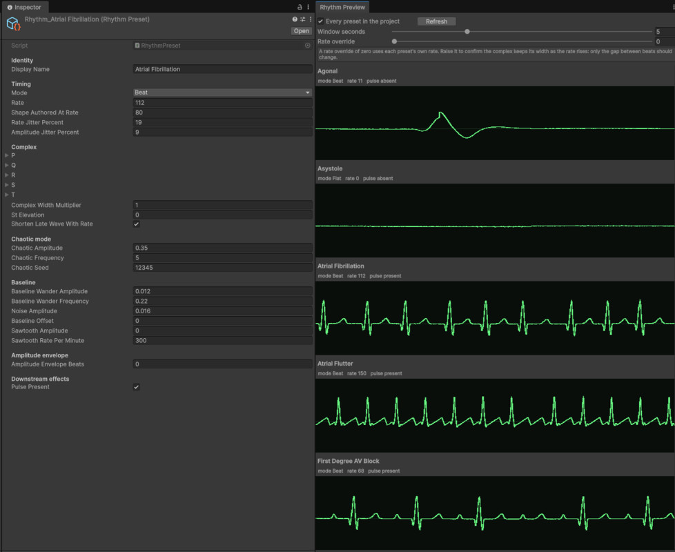 Heart Rate & Vitals Animated UI