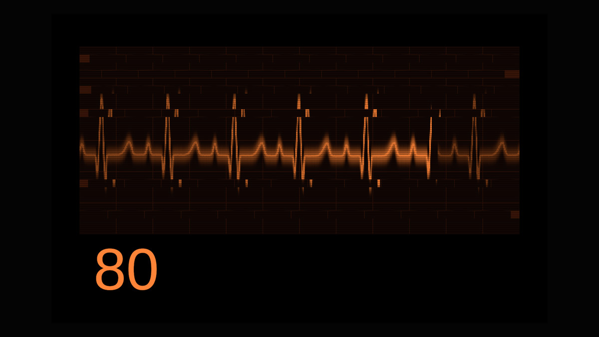 Heart Rate & Vitals Animated UI