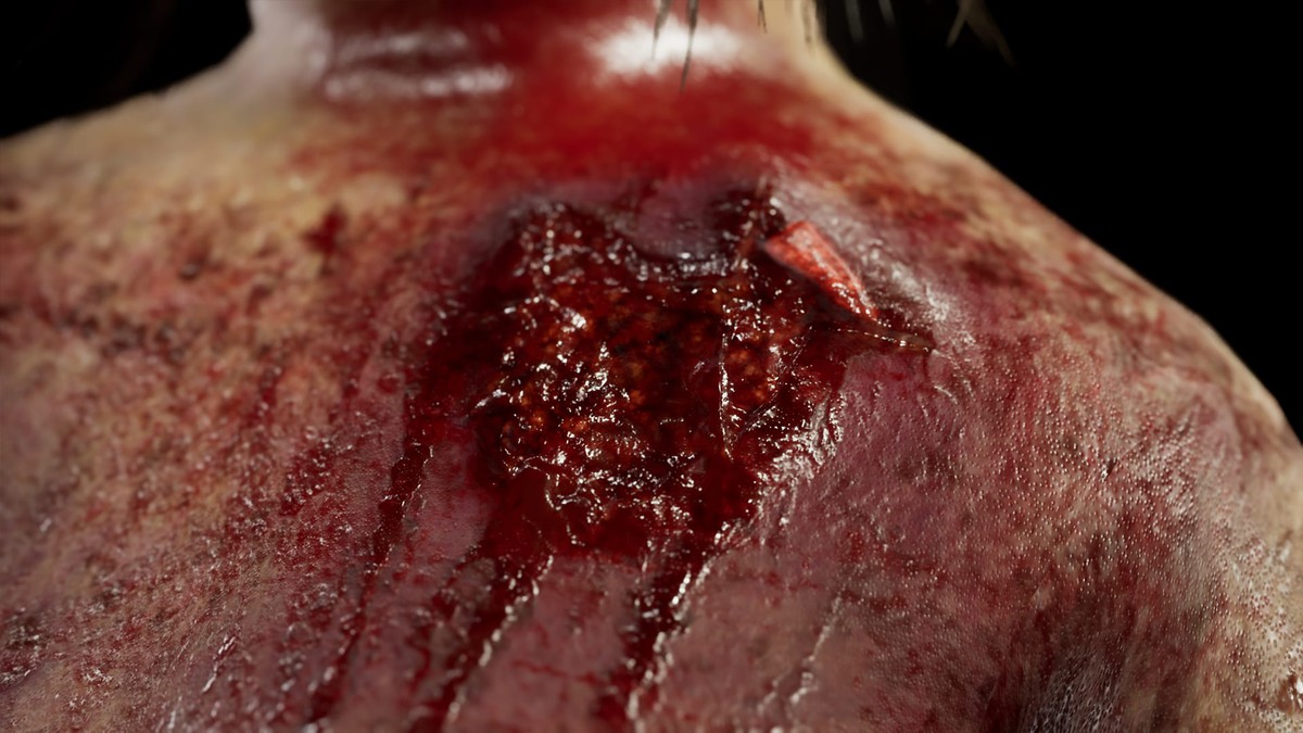 Zombie - Bloated Female|URP-HDRP|