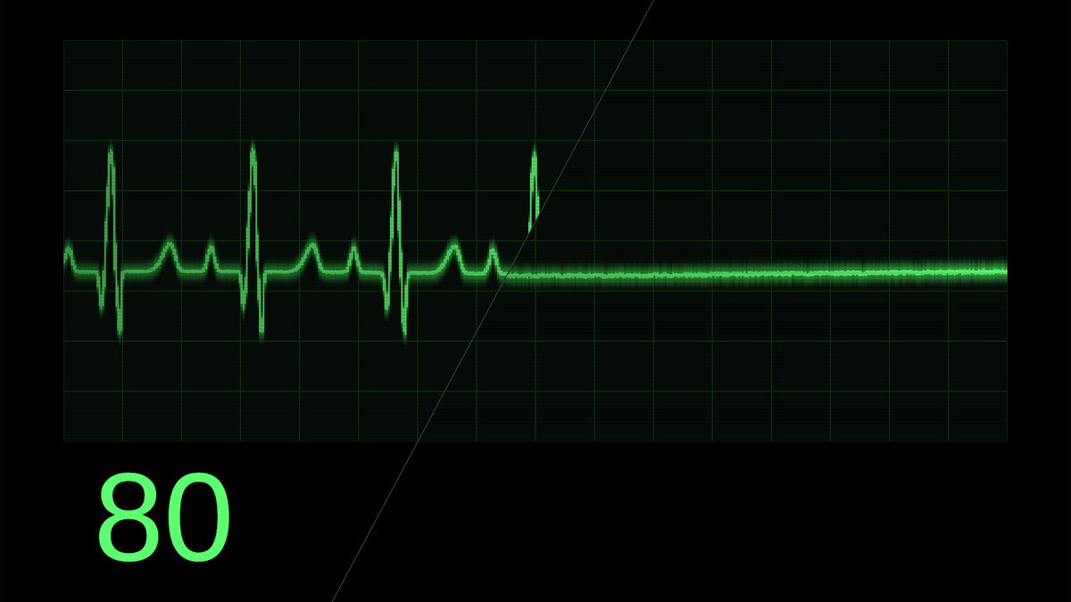 Heart Rate & Vitals Animated UI